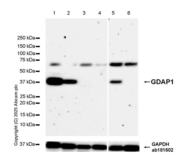 Western blot - Anti-GDAP1 antibody [EPR29581-48] (AB323844), expandable thumbnail