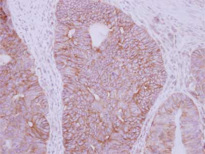 Immunohistochemistry (Formalin/PFA-fixed paraffin-embedded sections) - Anti-GDF 5 antibody (AB155670)
