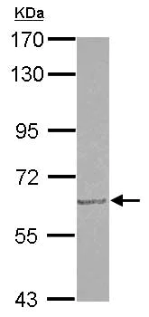 Western blot - Anti-GDF 5 antibody (AB155670)