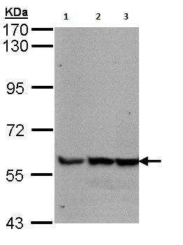 Western blot - Anti-GDF 5 antibody - C-terminal (AB137698)