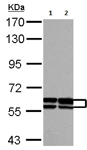 Western blot - Anti-GDF 5 antibody - C-terminal (AB137698)