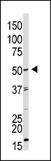 Western blot - Anti-GDF 9 antibody (AB38544)