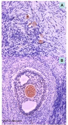 Immunohistochemistry (Formalin/PFA-fixed paraffin-embedded sections) - Anti-GDF 9 antibody (AB93892)