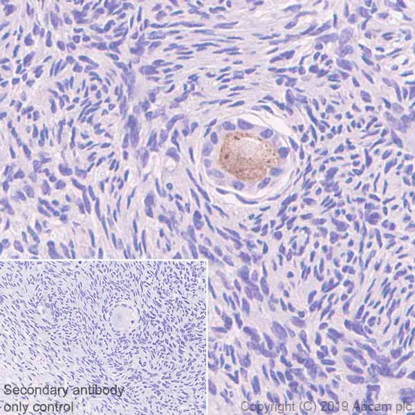 Immunohistochemistry (Formalin/PFA-fixed paraffin-embedded sections) - Anti-GDF 9 antibody [EPR22495-129] (AB254323)