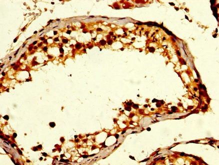 Immunohistochemistry (Formalin/PFA-fixed paraffin-embedded sections) - Anti-GDF10 antibody (AB235005), expandable thumbnail