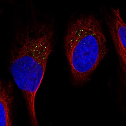 Immunocytochemistry/ Immunofluorescence - Anti-GDF11 antibody (AB220951)