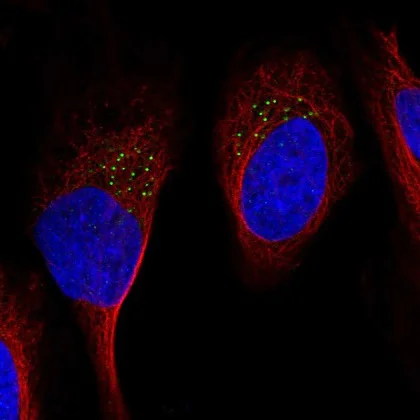 Immunocytochemistry/ Immunofluorescence - Anti-GDF11 antibody (AB220951)
