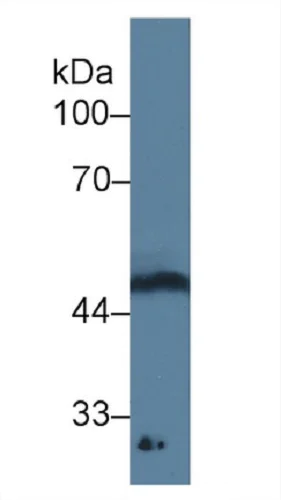 Western blot - Anti-GDF11 antibody [C4] (AB239515)