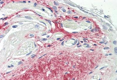 Immunohistochemistry (Formalin/PFA-fixed paraffin-embedded sections) - Anti-GDF15 antibody [6D12.H10.E4] (AB189358), expandable thumbnail