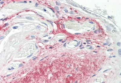 Immunohistochemistry (Formalin/PFA-fixed paraffin-embedded sections) - Anti-GDF15 antibody [6D12.H10.E4] (AB189358)