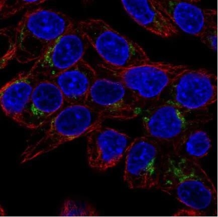 Immunocytochemistry/ Immunofluorescence - Anti-GDF15 antibody (AB211364)