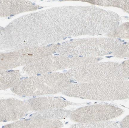Immunohistochemistry (Formalin/PFA-fixed paraffin-embedded sections) - Anti-GDF15 antibody (AB211364), expandable thumbnail