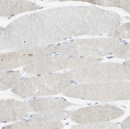 Immunohistochemistry (Formalin/PFA-fixed paraffin-embedded sections) - Anti-GDF15 antibody (AB211364)