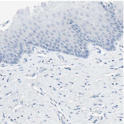 Immunohistochemistry (Formalin/PFA-fixed paraffin-embedded sections) - Anti-GDF15 antibody (ab211364), expandable thumbnail