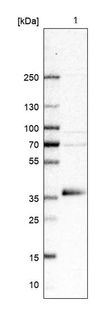 Western blot - Anti-GDF15 antibody (AB211364)