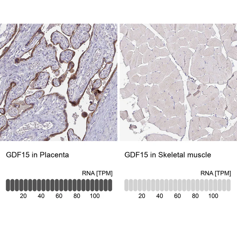 Immunohistochemistry (Formalin/PFA-fixed paraffin-embedded sections) - Anti-GDF15 Antibody [CL0328] (AB327102)