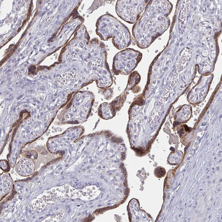 Immunohistochemistry (Formalin/PFA-fixed paraffin-embedded sections) - Anti-GDF15 Antibody [CL0328] (AB327102)