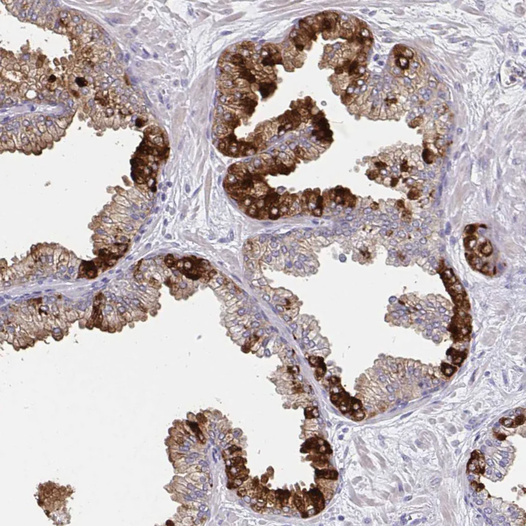 Immunohistochemistry (Formalin/PFA-fixed paraffin-embedded sections) - Anti-GDF15 Antibody [CL0328] (AB327102)