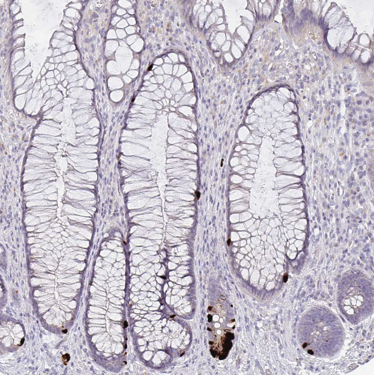 Immunohistochemistry (Formalin/PFA-fixed paraffin-embedded sections) - Anti-GDF15 Antibody [CL0328] (AB327102)