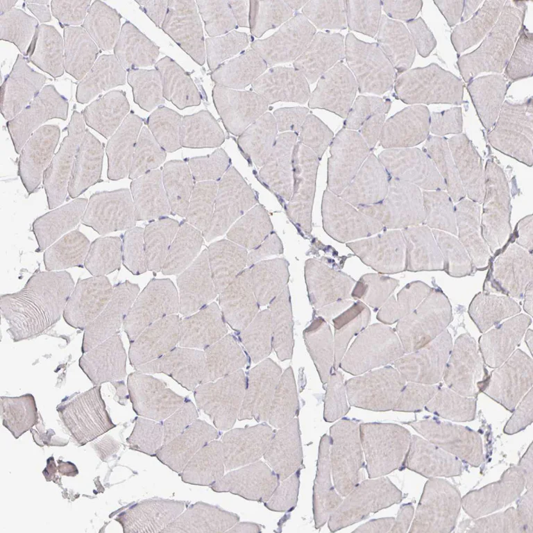 Immunohistochemistry (Formalin/PFA-fixed paraffin-embedded sections) - Anti-GDF15 Antibody [CL0328] (AB327102)