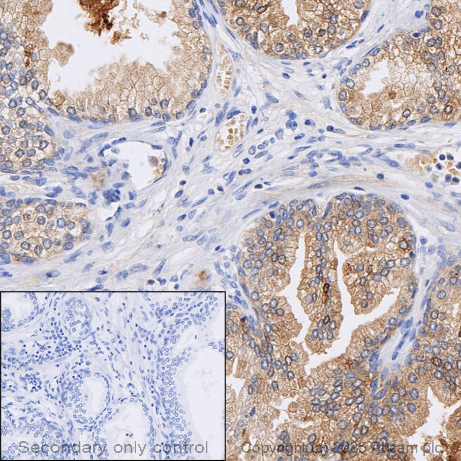 Immunohistochemistry (Formalin/PFA-fixed paraffin-embedded sections) - Anti-GDF15 antibody [EPR19939] (AB206414)