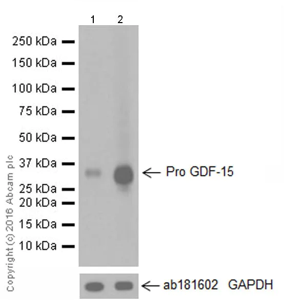 Western blot - Anti-GDF15 antibody [EPR19939] (AB206414)