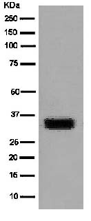 Western blot - Anti-GDF15 antibody [EPR6982(2)] (AB180929)