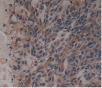 Immunohistochemistry (Formalin/PFA-fixed paraffin-embedded sections) - Anti-GDF3 antibody [A7] (AB239507)