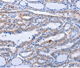 Immunohistochemistry (Formalin/PFA-fixed paraffin-embedded sections) - Anti-GDF3 antibody (AB197390)