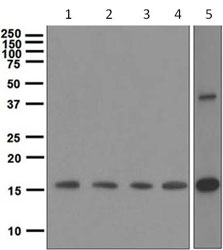 Western blot - Anti-GDF3 antibody [EPR4828] (AB108617)