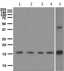 Western blot - Anti-GDF3 antibody [EPR4828] (AB108617)