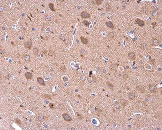 Immunohistochemistry (Formalin/PFA-fixed paraffin-embedded sections) - Anti-GDF6 antibody (AB226853)