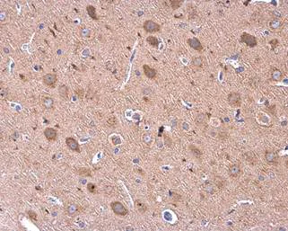 Immunohistochemistry (Formalin/PFA-fixed paraffin-embedded sections) - Anti-GDF6 antibody (AB226853)