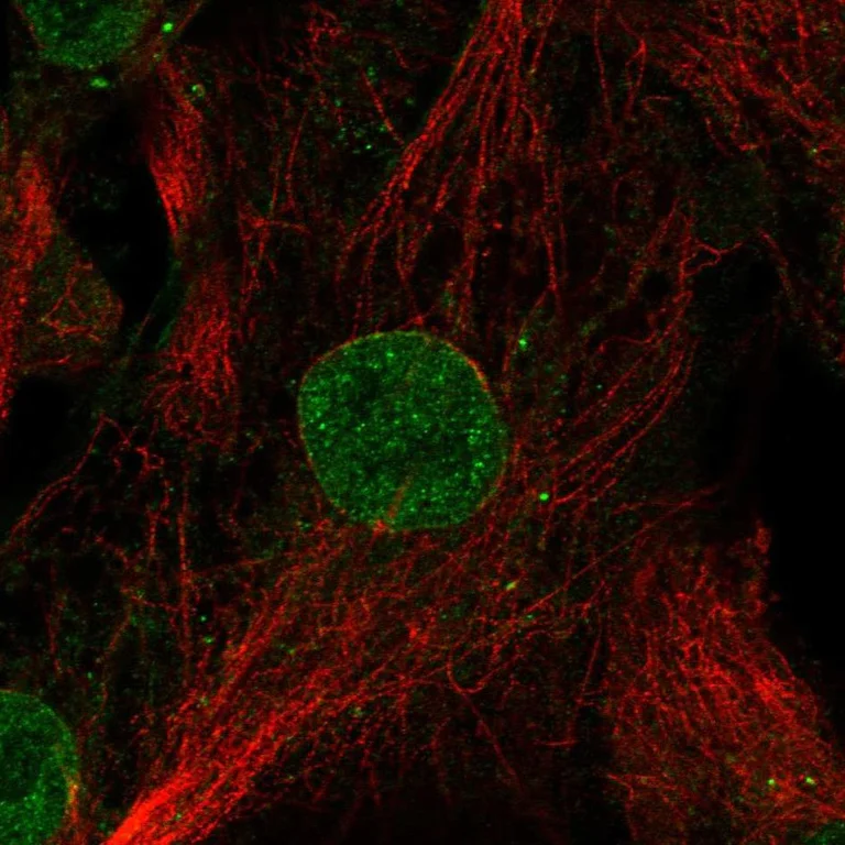Immunocytochemistry/ Immunofluorescence - Anti-GDF6 antibody (AB252979)
