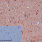 Immunohistochemistry (Formalin/PFA-fixed paraffin-embedded sections) - Anti-GDF7 antibody [EPR16000] - BSA and Azide free (AB251010), expandable thumbnail