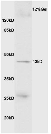 Western blot - Anti-GDF8 / Myostatin antibody (AB203076), expandable thumbnail
