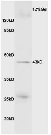 Western blot - Anti-GDF8 / Myostatin antibody (AB203076)