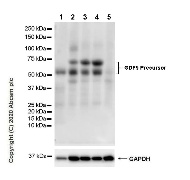 Western blot - Anti-GDF9 antibody [53/1] (AB273455)