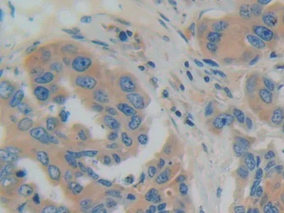 Immunohistochemistry (Formalin/PFA-fixed paraffin-embedded sections) - Anti-GDI1 antibody (AB233149)