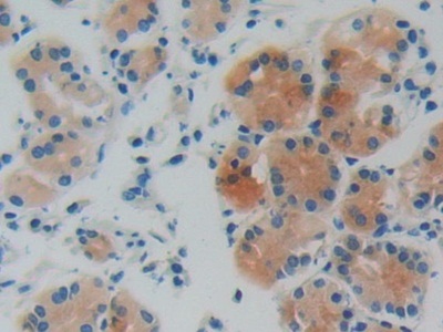 Immunohistochemistry (Formalin/PFA-fixed paraffin-embedded sections) - Anti-GDI1 antibody (AB233149)