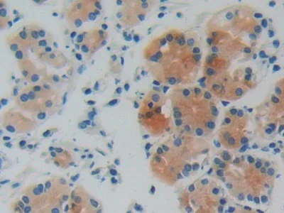 Immunohistochemistry (Formalin/PFA-fixed paraffin-embedded sections) - Anti-GDI1 antibody (AB233149)