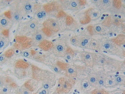 Immunohistochemistry (Formalin/PFA-fixed paraffin-embedded sections) - Anti-GDI1 antibody (AB233149)