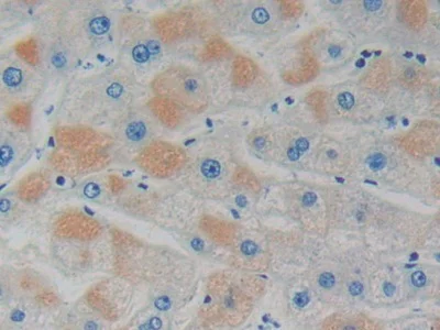 Immunohistochemistry (Formalin/PFA-fixed paraffin-embedded sections) - Anti-GDI1 antibody (AB233149)
