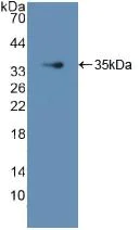 Western blot - Anti-GDI1 antibody (AB233149)