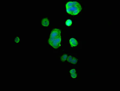 Immunocytochemistry/ Immunofluorescence - Anti-GDI1 antibody (AB236769)