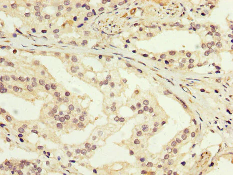 Immunohistochemistry (Formalin/PFA-fixed paraffin-embedded sections) - Anti-GDI1 antibody (AB236769)