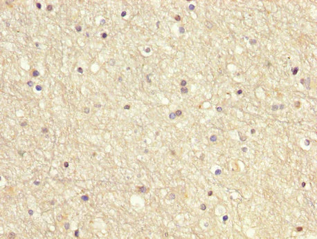 Immunohistochemistry (Formalin/PFA-fixed paraffin-embedded sections) - Anti-GDI1 antibody (AB236769)