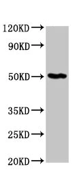Western blot - Anti-GDI1 antibody (AB236769)
