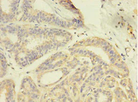 Immunohistochemistry (Formalin/PFA-fixed paraffin-embedded sections) - Anti-GDI2 antibody (AB234986)