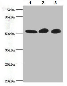 Western blot - Anti-GDI2 antibody (AB234986)